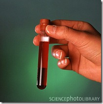 test-tube_containing_blood_sample-SPL test-tube_containing_blood_sample-SPL